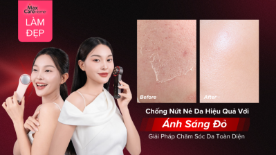 Liệu Pháp Ánh Sáng Đỏ - Bí Quyết Chống Nứt Nẻ Mùa Đông