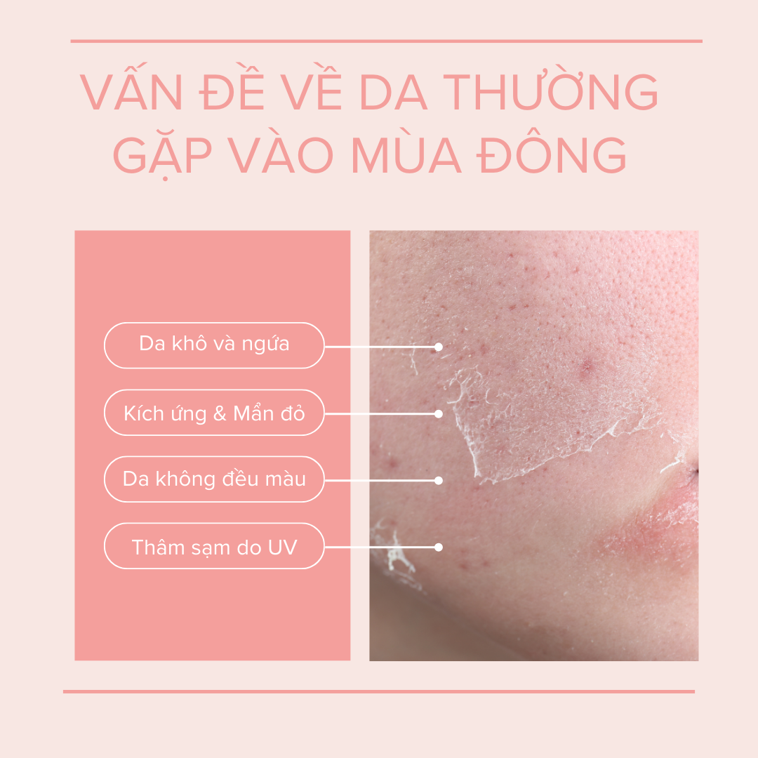 van-de-da-mua-dong