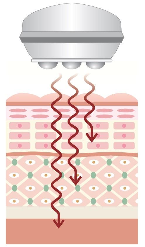 cong_nghe_IW_trong_may_nang_co_belega