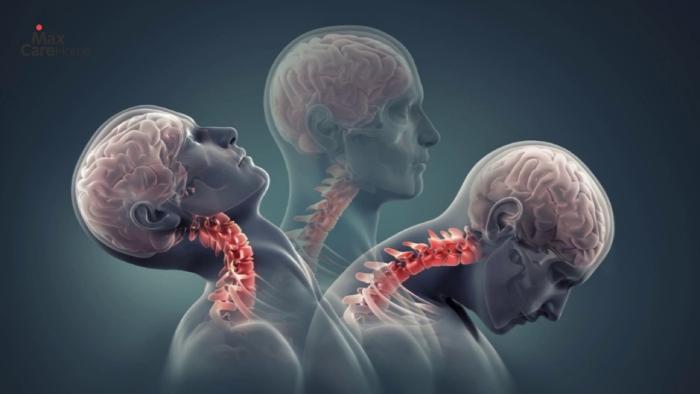 Bệnh lý xương khớp là nguyên nhân phổ biến gây đau vai gáy bên trái