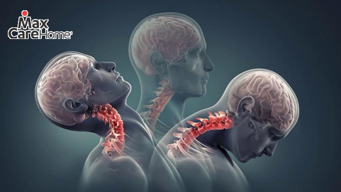 Các tác động sinh học bên trong cơ thể gây đau mỏi vai gáy