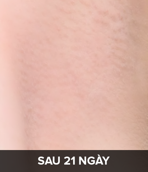 Sau 21 ng&agrave;y