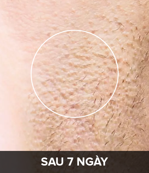 Sau 7 ng&agrave;y